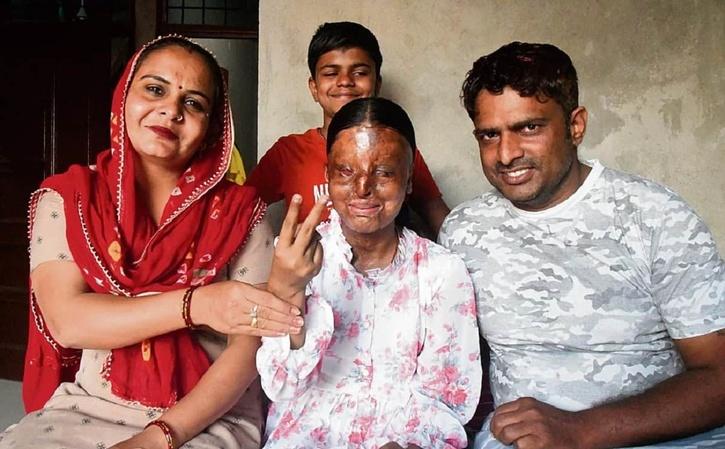acid-attack-survivor-tops-board-exams-with-a-whopping-95-6-per-cent-aspires-to-be-an-ias-officer